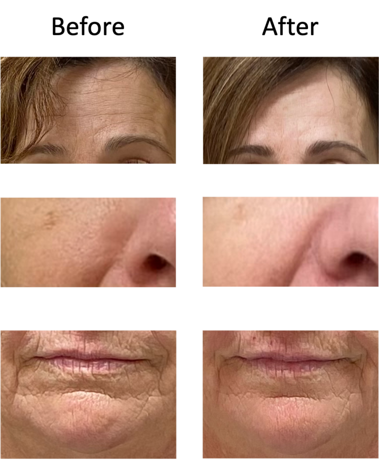 The benefits of light therapy